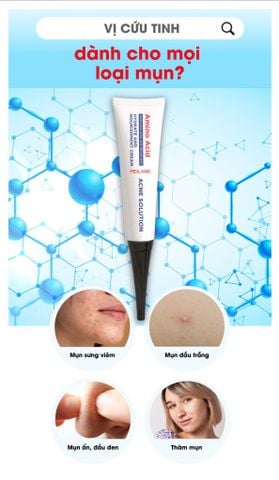  Kem dưỡng da vùng mụn, giúp kháng khuẩn và nhanh khô nhân mụn Peiland Acne Solution 