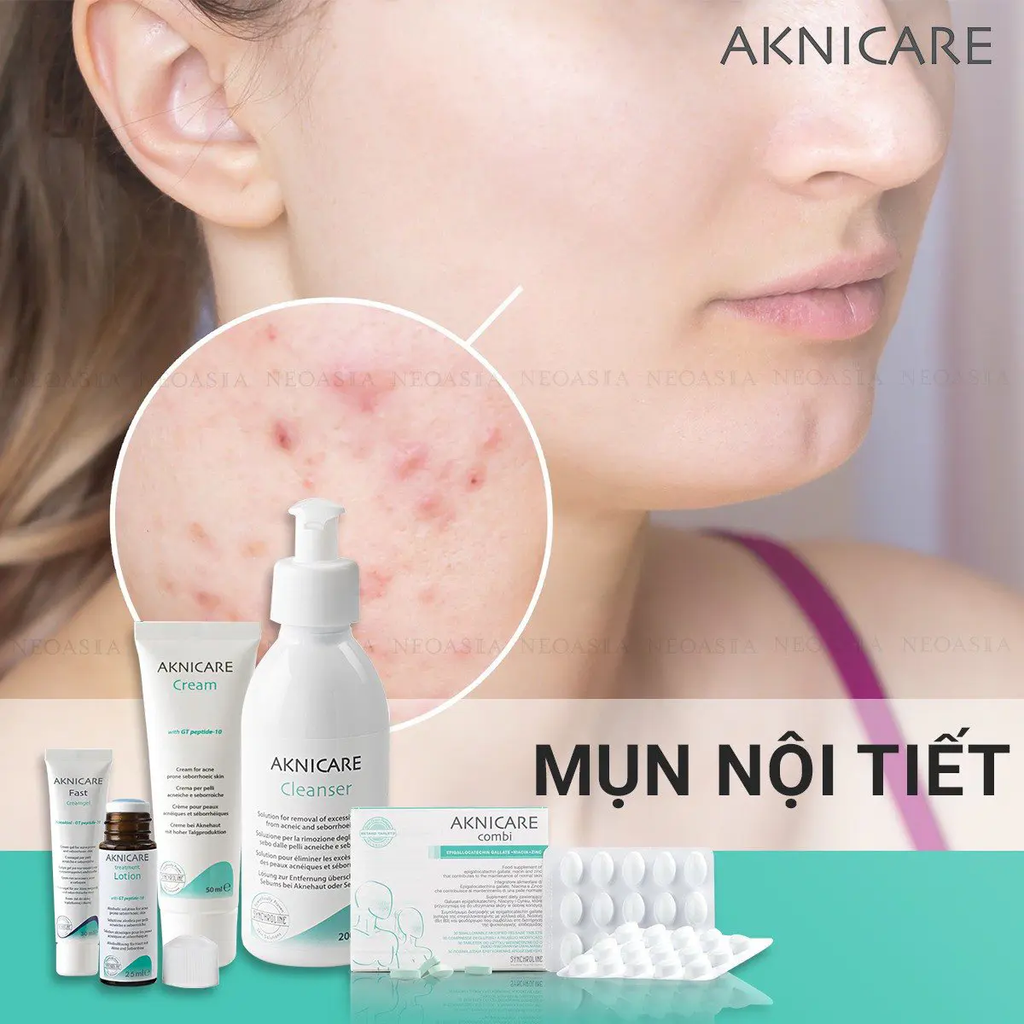 Viên Uống Hỗ Trợ Giảm Mụn Điều Tiết Bã Nhờn Aknicare Combi Hộp 30 Viên