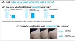 Gel Rửa Mặt Hỗ Trợ Giảm Mụn Cho Mặt Và Toàn Thân La Roche-Posay Effaclar Micro-Peeling Purifying Gel 400ml