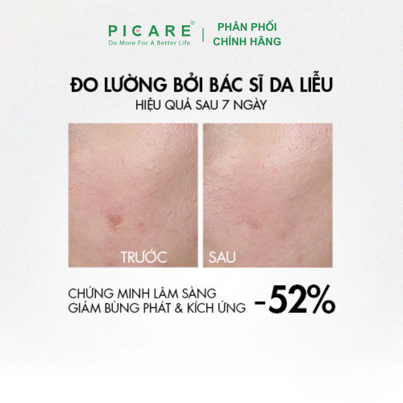 Tinh chất giúp dịu da tức thì và giảm mụn rõ rệt sau 7 ngày Vichy Normaderm Probio-BHA 30ml