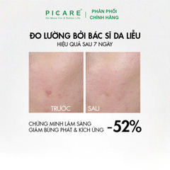 Tinh chất giúp dịu da tức thì và giảm mụn rõ rệt sau 7 ngày Vichy Normaderm Probio-BHA 30ml