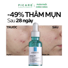 Tinh chất dưỡng giúp giảm mụn 3 tác động La Roche Posay Effaclar Serum 30ml