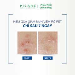 Kem dưỡng Ducray cân bằng dầu giảm viêm mụn Ducray Keracnyl PP Anti-Blemish Soothing Cream 30ml