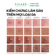 Kem Dưỡng Giảm Mụn, Ngừa Thâm La Roche-Posay Effaclar Duo+ 40ml