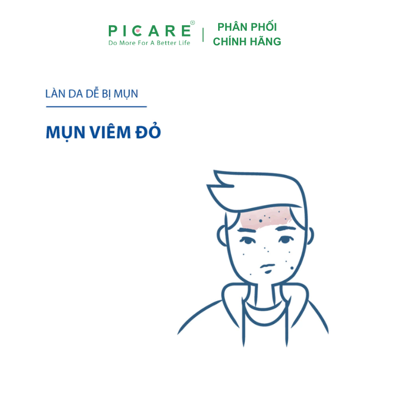 Kem dưỡng Ducray cân bằng dầu giảm viêm mụn Ducray Keracnyl PP Anti-Blemish Soothing Cream 30ml