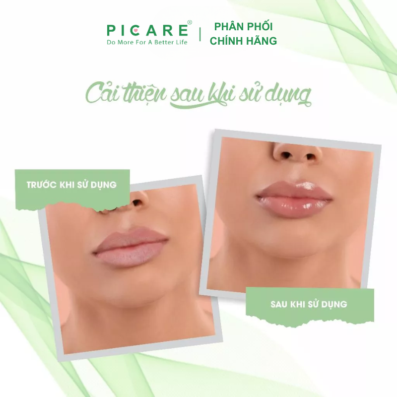 Son dưỡng môi cấp ẩm Fixderma Lip Balm 15ml