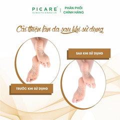 Kem Dưỡng Mềm Gót Chân Fixderma Foot Cream 60g