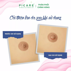 Kem Dưỡng Ẩm, Làm Mềm Da Và Núm Vú Fixderma Preggers Soothing Nipple Cream 20g