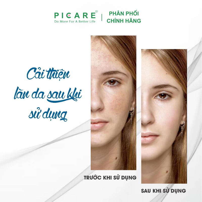 Serum sáng da FCL Skin Brightening Complex 30ml