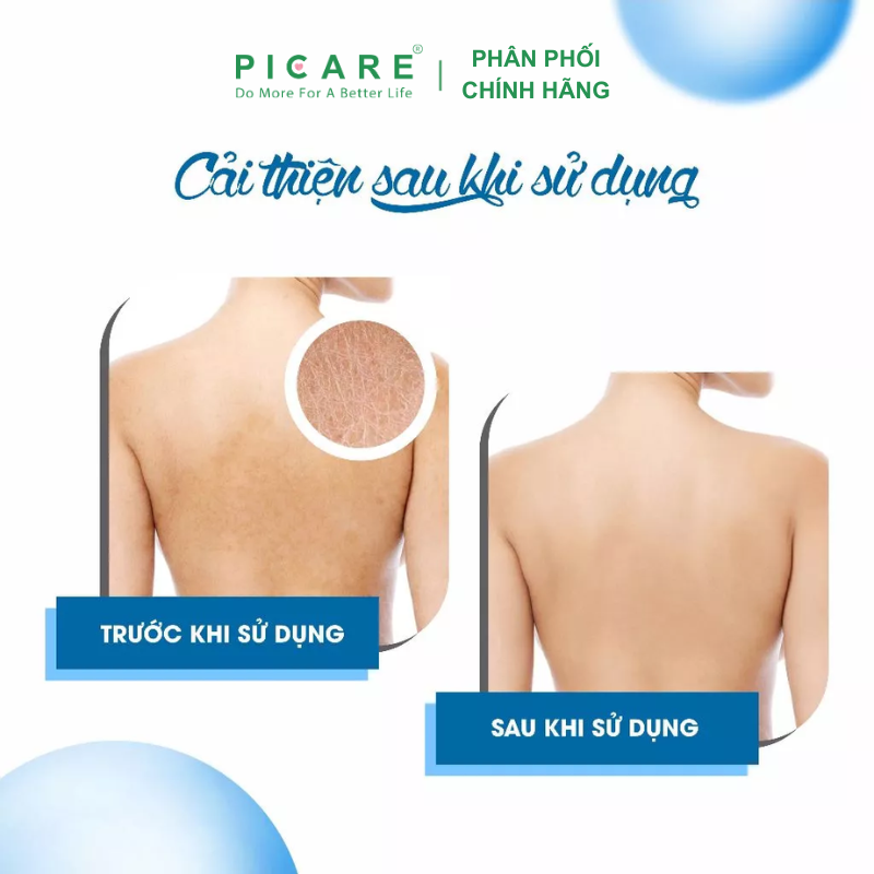 Sữa Tắm Dưỡng Ẩm Giảm Ngứa, Khô Da, Sáng Da FCL Oatsilk Soap Free Body Wash 200ml