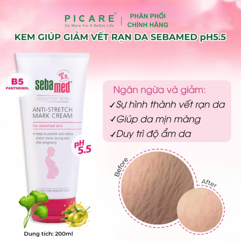 Kem Ngăn Ngừa Rạn Da Bà Bầu pH5.5 SEBAMED Anti-Stretch Mark Cream 200ml