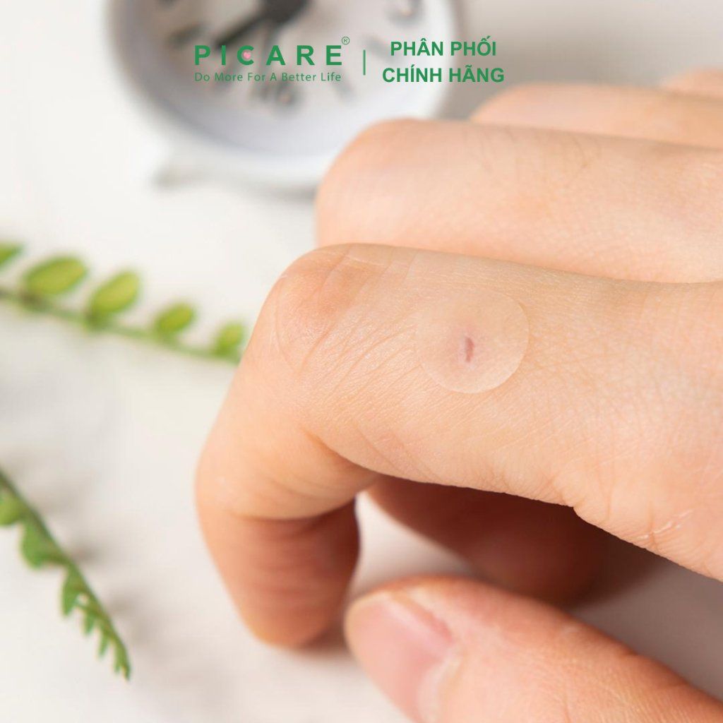Miếng dán mụn che khuyết điểm và giảm mụn Elaband Hydro Dot Tea Tree (Hộp 23 miếng)