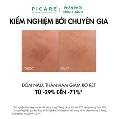 Tinh chất giúp cải thiện & ngăn ngừa thâm nám đốm nâu toàn diện Vichy Liftactiv B3 Dark Spots Serum 30ml