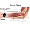 Đồng hồ giảm chấn Elbow cho Tennis-Pickleball TENEX ULTRA elbow shock absorber (TELBS)