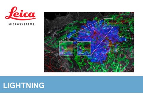 Leica – Kính hiển vi đồng tiêu Lightning