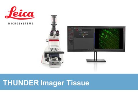 Leica – Kính hiển vi huỳnh quang THUNDER Imager Tissue