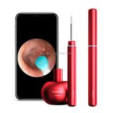  Bebird M9 Pro Wifi không dây độ nét cao Thìa nhét tai trực quan 3 triệu điểm ảnh Thìa chụp tai trực quan (Đen) 