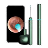 Bebird M9 Pro Wifi không dây độ nét cao Thìa nhét tai trực quan 3 triệu điểm ảnh Thìa chụp tai trực quan (Đen) 
