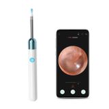  X1 WIFI Visual Visual Ear Pick HD Nội soi tai kỹ thuật số (Đen) 