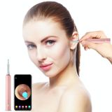  Bebird C3 Pro 2.4G 3.5mm Wifi không dây độ nét cao Thìa nhét tai trực quan 3 triệu điểm ảnh Thìa chụp tai trực quan (Hồng) 