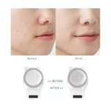  YJK059 Ánh sáng màu đa năng Dụng cụ làm đẹp ion âm (Trắng) 