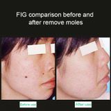  Máy cầm tay Picosecond Portable (Xóa vết xăm tàn nhang) Máy Laser Plasma Beauty Care Pen, EU Plug (Blue Light) 