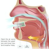  Thiết bị bảo vệ miệng chống ngáy ngủ tại nhà dành cho người lớn Yuknight 