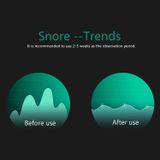  Thiết bị chống ngáy ngủ thông minh Home dành cho người lớn 