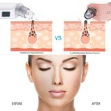  K-SKIN KD803A Hút mụn đầu đen 3 cấp độ Máy làm sạch lỗ chân lông Máy làm sạch da mặt có thể sạc lại 