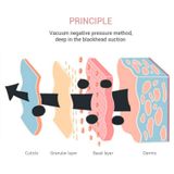  K-SKIN KD803A Hút mụn đầu đen 3 cấp độ Máy làm sạch lỗ chân lông Máy làm sạch da mặt có thể sạc lại 