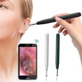  W2 WiFi Smart Visual Ear Pick Cleaning Kit Công cụ loại bỏ ráy tai bằng đèn LED (Màu trắng) 