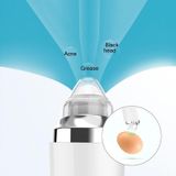  Dụng cụ làm đẹp tại nhà Dụng cụ làm sạch mụn đầu đen bằng điện trực quan WIFI (Hồng) 