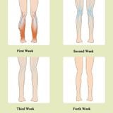  Chân mát xa bắp chân sóng không khí mát xa thiết bị vật lý trị liệu tĩnh vật vEin, đặc điểm kỹ thuật: nâng cấp loại sốt 