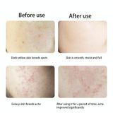  Dụng cụ bổ sung nước nano áp suất cao Beemyi dụng cụ nhỏ cầm tay hộ gia đình cầm tay dụng cụ tiêm oxy, màu: BS-1200 Trắng 