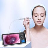  Ống soi tai màn hình thông minh HD TESLONG MS450 4,5 inch với thẻ nhớ 32GB 