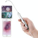  Supereyes Y001+ 4mm Ống Tiêu Điểm Mũi Họng Nội Soi Điện Tử Trong Miệng 