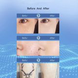  15 bánh răng có thể sạc lại Mole Spotting Pen Laser Beauty Instrument Spot Removal Magic Tool (Màu vàng kim) 