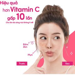 Kem Pond's White Beauty Dưỡng da ban ngày và đêm, Trắng Hồng Rạng Rỡ