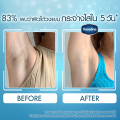 Trị Thâm Nách Khử Mùi Vaseline 50ml