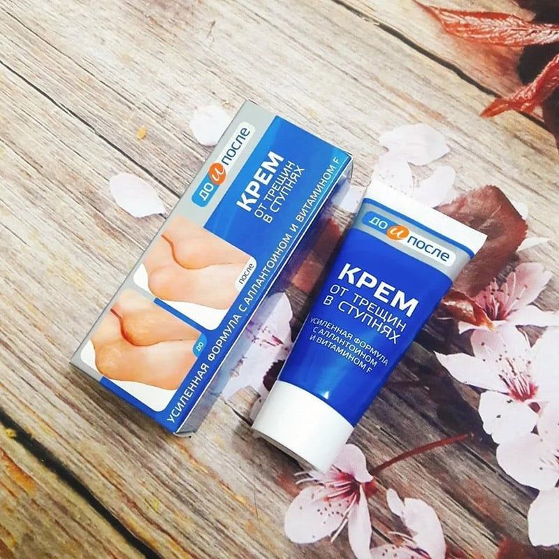 Kem Trị Nứt Gót Kpem Apteka Nga 50ml