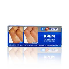 Kem Trị Nứt Gót Kpem Apteka Nga 50ml