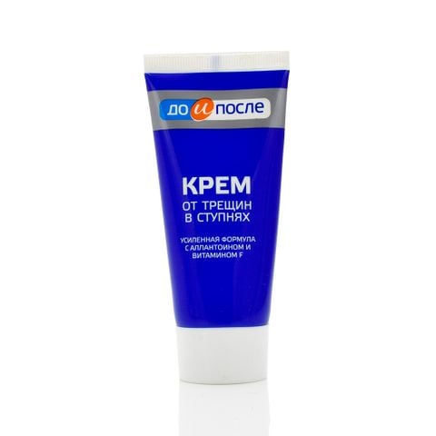 Kem Trị Nứt Gót Kpem Apteka Nga 50ml