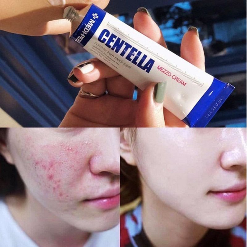 Kem phục hồi da Medi peel Centella Mezzo cream 30ml