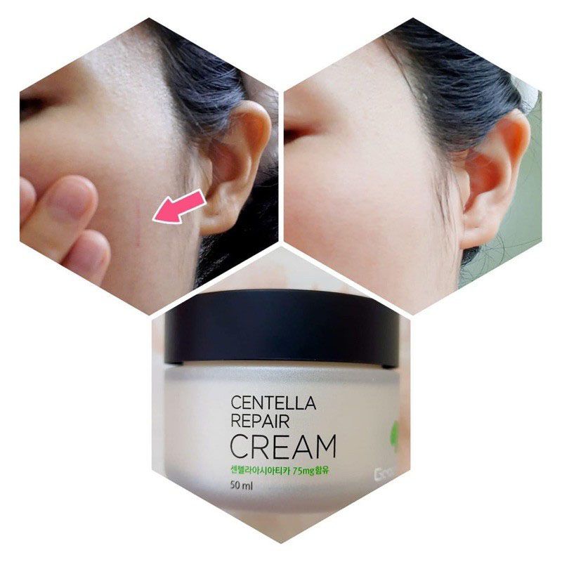 Kem Dưỡng Chiết Xuất Rau Má GoodnDoc Centella Repair Cream 50ml Hàn Quốc