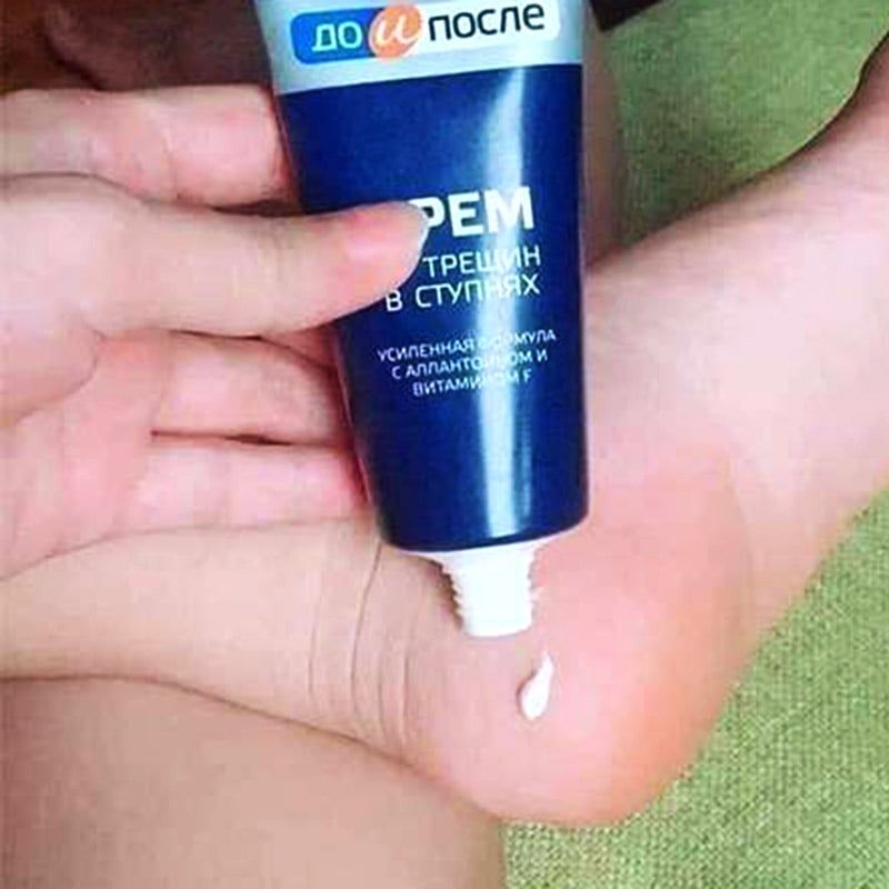 Kem Trị Nứt Gót Kpem Apteka Nga 50ml