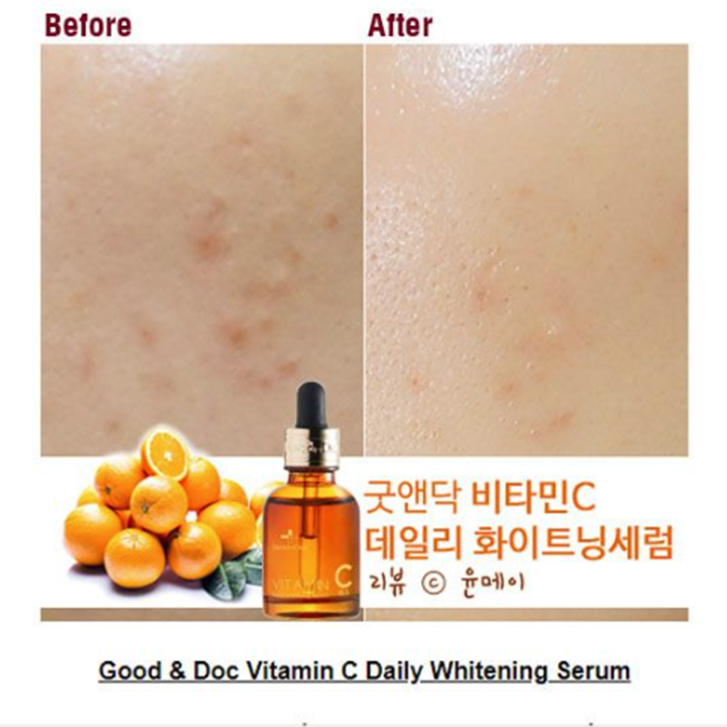 Serum Goodndoc 30ml Vitamin C 16.5, Làm mờ thâm nám, tàn nhang, da không đều màu