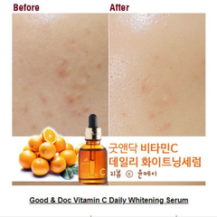 Serum Goodndoc 30ml Vitamin C 16.5, Làm mờ thâm nám, tàn nhang, da không đều màu