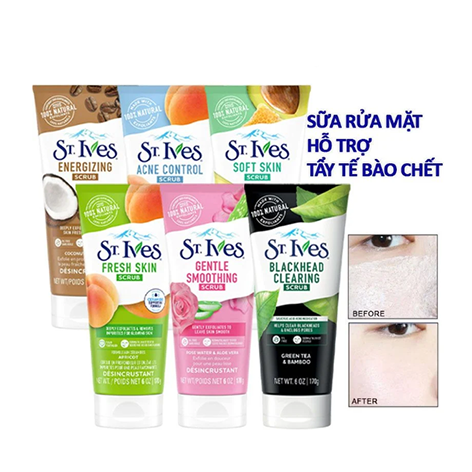 Sữa Rửa Mặt Tẩy Tế Bào Chết  St.Ives