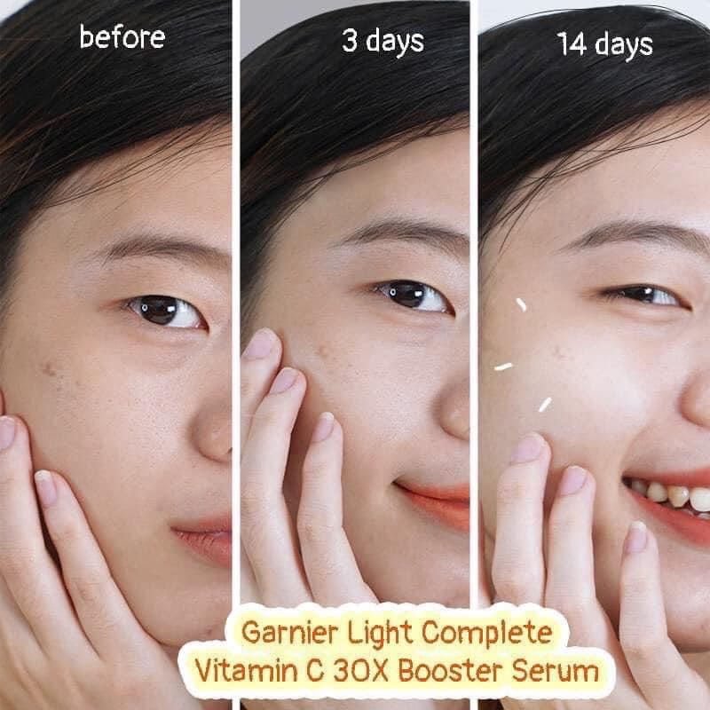 Tinh Chất Garnier 30ml Booster Serum Dưỡng Sáng Da Mờ Thâm