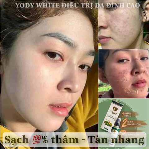 Serum Yody Phương Anh 80ml Tái Tạo Da